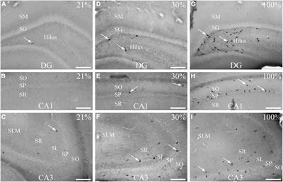Short-term hyperoxia-induced functional and morphological changes in rat hippocampus